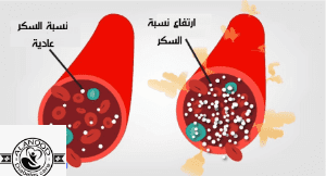 كيف تعرف النسبة الطبيعية لسكر الدم بعد الاكل