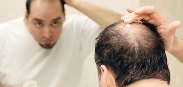 علاج تساقط الشعر للرجال وتكثيفه.