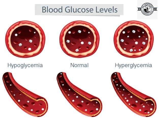 أعراض ارتفاع سكر الدم والأسباب التي تؤدي إلى ظهورها