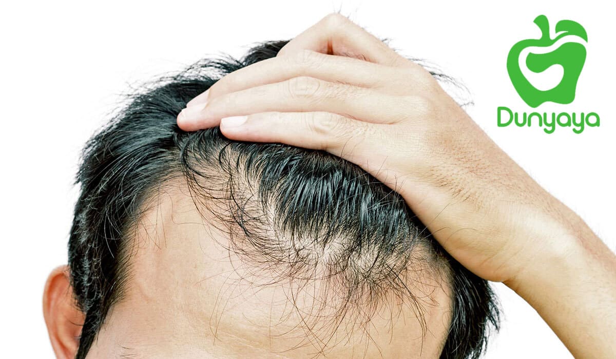 فيتامينات للشعر للرجال علاج تساقط الشعر للرجال
