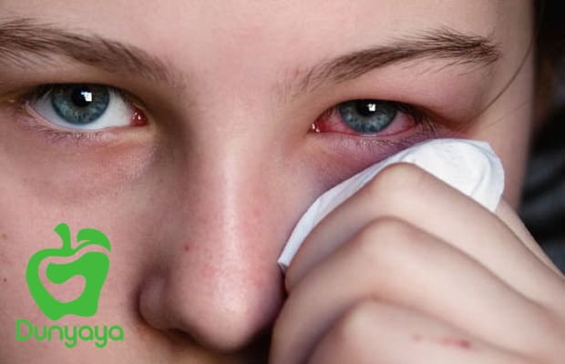 قطرات لعلاج التهابات العين